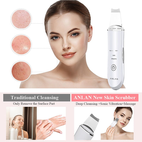 Ultrasonic Skin Scrubber Face Cleanser Blackhead Acne Removal Facial Spa Vibration Massager